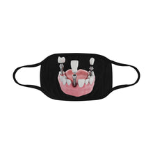 #Implants# Mouth Mask