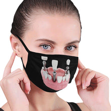 #Implants# Mouth Mask